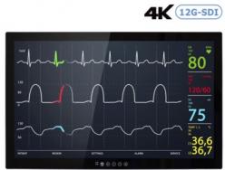 Winmate社 医療向け4K-UHD27インチモニター M270TF-SDI